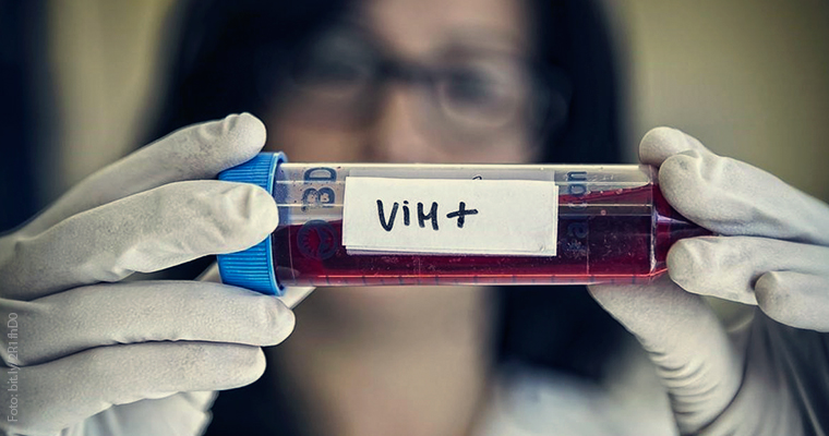 Gobierno fortalece detección gratuita para cumplir meta contra el VIH.